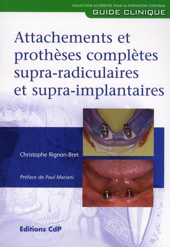 Couverture du livre « Attachements et prothèses complètes supra-radiculaires et supra-implantaires » de Christophe Rignon-Bret aux éditions Cahiers De Protheses