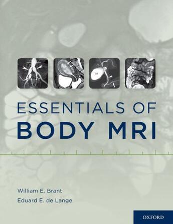 Couverture du livre « Essentials of Body MRI » de William E Brant aux éditions Oxford University Press Usa