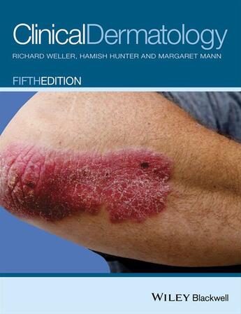 Couverture du livre « Clinical Dermatology » de Margaret W. Mann et Richard Weller et Hamish Hunter aux éditions Wiley-blackwell