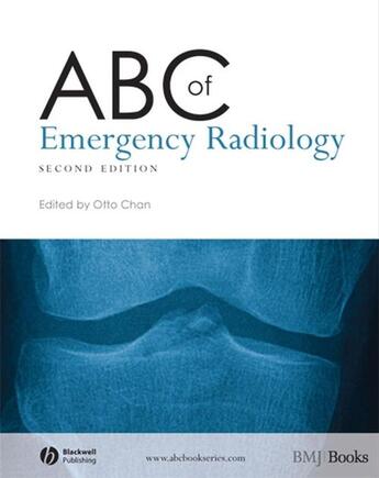 Couverture du livre « ABC of Emergency Radiology » de Otto Chan aux éditions Bmj Books