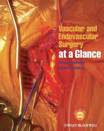 Couverture du livre « Vascular and Endovascular Surgery at a Glance » de Matthew Stephenson et Morgan Mcmonagle aux éditions Wiley-blackwell