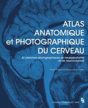 Couverture du livre « Atlas anatomique et photographique du cerveau : 42 planches (dont 41 photographiques) de neuroanatomie et de neurosciences » de Vincent Di Marino et Yves Etienne et Maurice Niddam aux éditions Pu De Provence