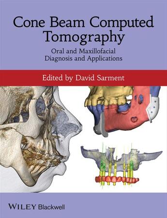 Couverture du livre « Cone Beam Computed Tomography » de David Sarment aux éditions Wiley-blackwell