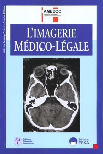 Couverture du livre « Imagerie medicolegale » de Amedoc aux éditions Eska