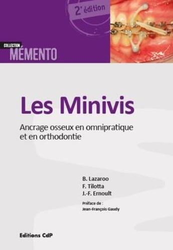 Couverture du livre « Les minivis ; ancrage osseux en omnipratique et en orthodontie (2e édition) » de Bernard Lazaroo et Francoise Tilotta et Jean-Francois Ernoult aux éditions Cahiers De Protheses