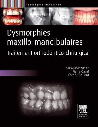 Couverture du livre « Dysmorphies maxillo-mandibulaires ; traitement orthodontico-chirurgical » de Pierre Canal et Patrick Goudot aux éditions Elsevier-masson