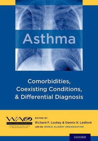 Couverture du livre « Asthma: Comorbidities, Coexisting Conditions, and Differential Diagnos » de Richard F Lockey aux éditions Oxford University Press Usa