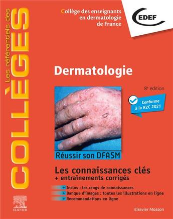 Couverture du livre « Dermatologie : réussir son DFASM ; les connaissances clés + entraînements corrigés (8e édition) » de  aux éditions Elsevier-masson