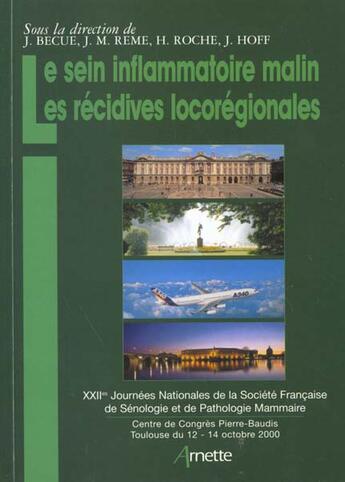 Couverture du livre « Le sein inflammatoire malin et recidives loco-regionales » de  aux éditions Arnette