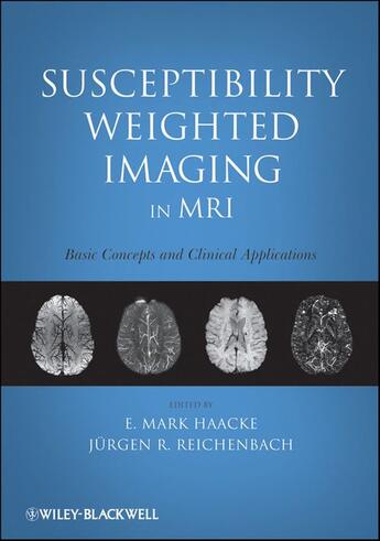 Couverture du livre « Susceptibility Weighted Imaging in MRI » de E. Mark Haacke et JÜ et Rgen R. Reichenbach aux éditions Wiley-blackwell