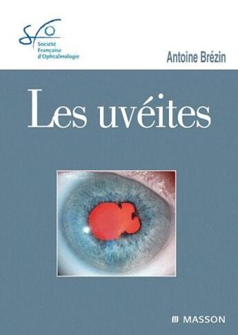 Couverture du livre « Les uvéites » de Antoine Brezin aux éditions Elsevier-masson