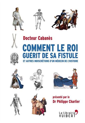 Couverture du livre « Comment le roi guérit de sa fistule ; et autres indiscrétions d'un médecin de l'histoire » de Augustin Cabanes aux éditions Vuibert