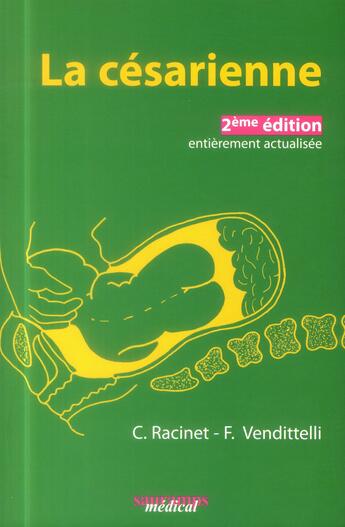 Couverture du livre « La césarienne » de Claude Racinet et Francoise Vendittelli aux éditions Sauramps Medical