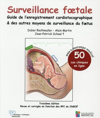 Couverture du livre « Surveillance foetale ; guide de l'enregistrement cardiotocographique & autres moyens de surveillance du foetus » de Didier Riethmuller et Jean-Patrick Schaal et Alain Martin aux éditions Sauramps Medical