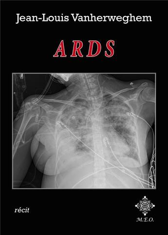 Couverture du livre « Ards » de Jean-Louis Vanherweghem aux éditions Meo