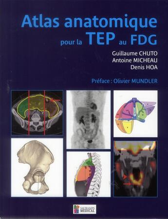 Couverture du livre « Atlas anatomique pour la TEP au FDG » de Antoine Micheau et Denis Hoa et Guillaume Chuto aux éditions Sauramps Medical