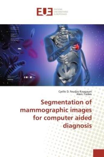 Couverture du livre « Segmentation of mammographic images for computer aided diagnosis » de Kougoum aux éditions Editions Universitaires Europeennes