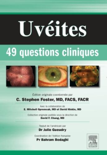 Couverture du livre « Uvéites : 49 questions cliniques » de  aux éditions Elsevier-masson