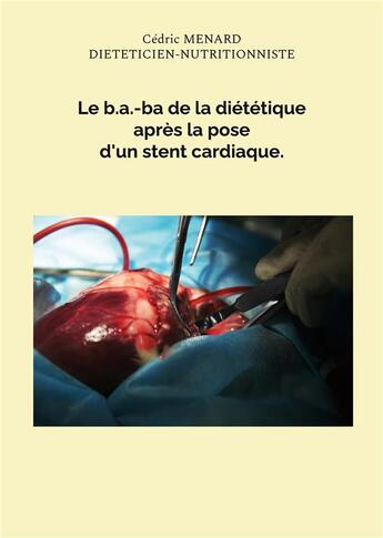 Couverture du livre « Le b.a.-ba de la diététique après la pose d'un stent cardiaque. » de Cedric Menard aux éditions Books On Demand