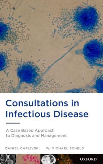 Couverture du livre « Consultations in Infectious Disease: A Case Based Approach to Diagnosi » de Scheld W Michael aux éditions Oxford University Press Usa