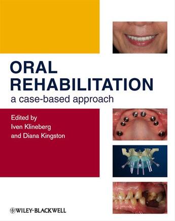 Couverture du livre « Oral Rehabilitation » de Iven Klineberg et Diana Kingston aux éditions Wiley-blackwell