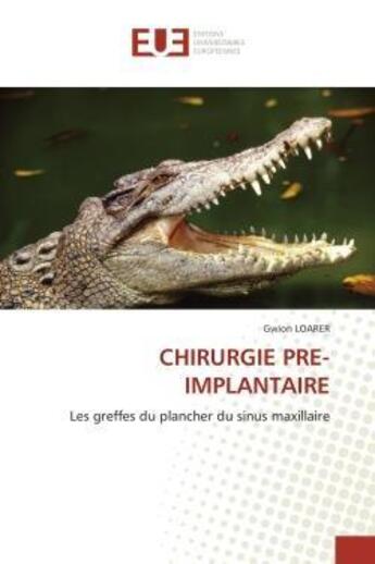 Couverture du livre « Chirurgie pre-implantaire - les greffes du plancher du sinus maxillaire » de Loarer Gwion aux éditions Editions Universitaires Europeennes