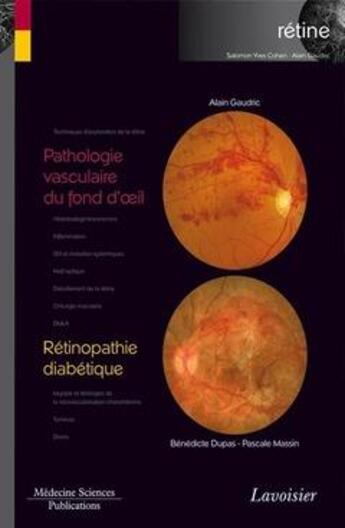 Couverture du livre « Pathologie vasculaire du fond d'oeil ; rétinopathie diabétique » de Alain Gaudric et Benedicte Dupas et Pascale Massin aux éditions Lavoisier Medecine Sciences