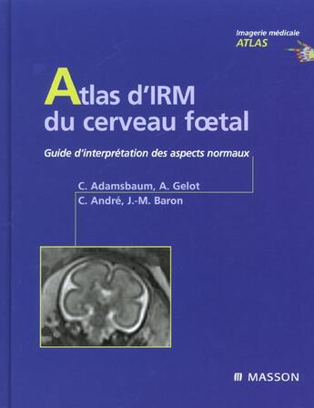 Couverture du livre « Atlas d irm du cerveau f tal » de Catherine Adamsbaum aux éditions Elsevier-masson