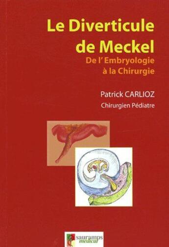 Couverture du livre « Le diverticule de Meckel ; de l'embryologie à la chirurgie » de Patrick Carlioz aux éditions Sauramps Medical