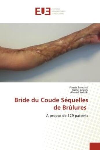 Couverture du livre « Bride du coude sequelles de brulures - a propos de 129 patients » de Benrahal/Graichi aux éditions Editions Universitaires Europeennes