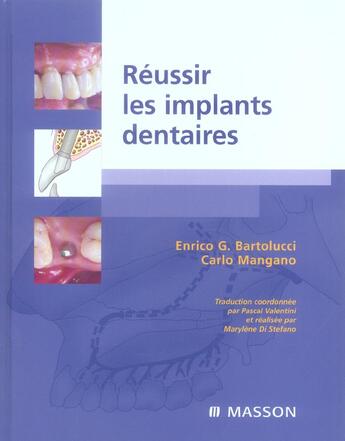 Couverture du livre « Réussir les implants dentaires » de Bartolucci/Mangano aux éditions Elsevier-masson