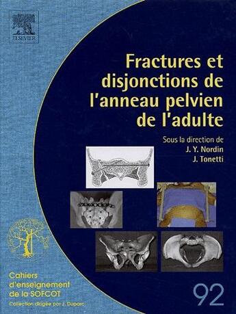 Couverture du livre « Fractures et disjonctions de l'anneau pelvien de l'adulte » de J.Y. Nordin et J Tonetti aux éditions Elsevier-masson