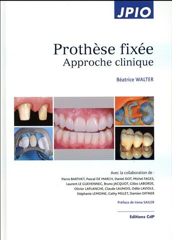 Couverture du livre « Prothèse fixée » de Beatrice Walter aux éditions Cahiers De Protheses