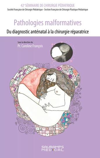 Couverture du livre « Pathologies malformatives : du diagnostic anténatal à la chirurgie réparatrice » de Caroline Francois et Collectif aux éditions Sauramps Medical