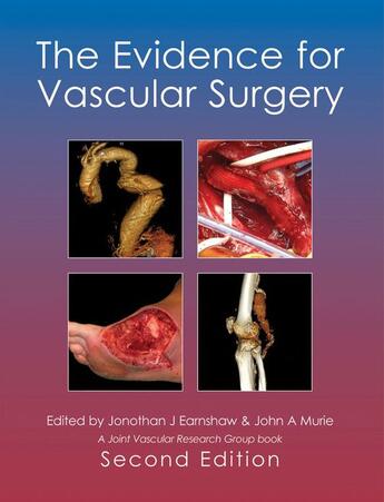 Couverture du livre « The Evidence for Vascular Surgery; second edition » de Jonothan Earnshaw et John Murie aux éditions Tfm Publishing Ltd