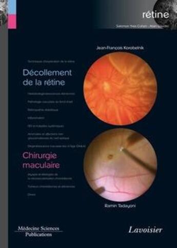 Couverture du livre « Décollement de la rétine ; chirurgie maculaire » de Jean-Francois Korobelnik et Ramin Tadayoni aux éditions Lavoisier Medecine Sciences