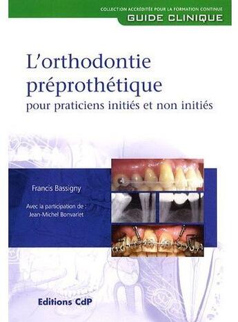 Couverture du livre « L'orthodontie preprothetique pour practitiens inities et non inities » de Bassigny Francis aux éditions Cahiers De Protheses