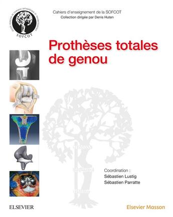 Couverture du livre « Prothèses totales de genou » de Sebastien Lustig et Sebastien Parratte aux éditions Elsevier-masson