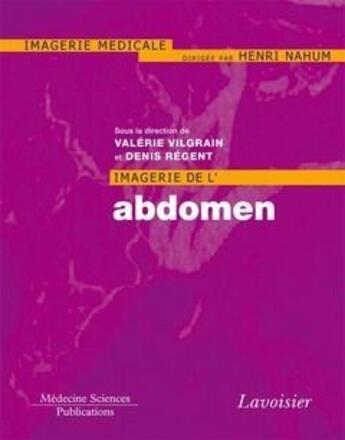 Couverture du livre « Imagerie de l'abdomen » de Valerie Vilgrain et Denis Regent aux éditions Lavoisier Medecine Sciences