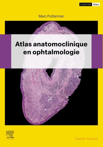 Couverture du livre « Atlas anatomoclinique en ophtalmologie » de Marc Putterman aux éditions Elsevier-masson