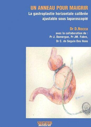 Couverture du livre « Un anneau pour maigrir ; la gastroplastie horizontale calibrée ajustable sous laparoscopie » de D. Nocca et J. Domergue et Jm. Fabre et C. De Seguin Des Hons aux éditions Sauramps Medical