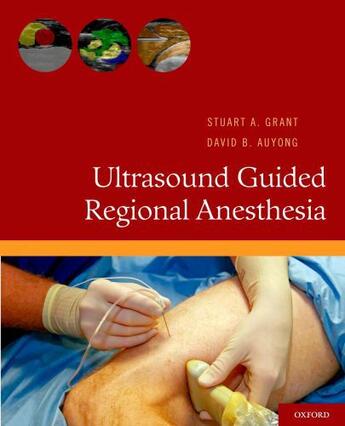 Couverture du livre « Ultrasound Guided Regional Anesthesia » de Auyong David B aux éditions Oxford University Press Usa