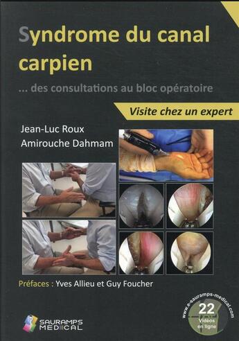 Couverture du livre « Syndrome du canal carpien : ... des consultations au bloc opératoire ; visite chez un expert » de Jean-Luc Roux et Amirouche Dahmam aux éditions Sauramps Medical