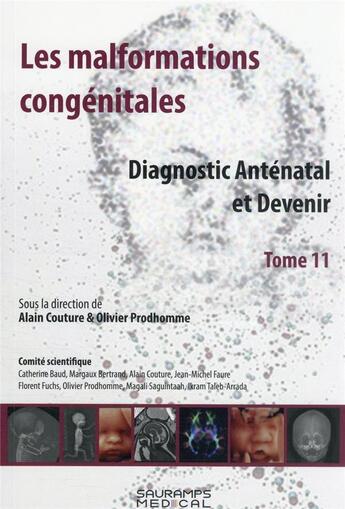 Couverture du livre « Les malformations congenitales t.11 : diagnostic anténatal et devenir » de Alain Couture et Olivier Prodhomme aux éditions Sauramps Medical