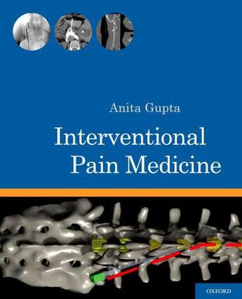 Couverture du livre « Interventional Pain Medicine » de Anita Gupta aux éditions Oxford University Press Usa