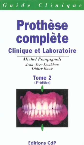 Couverture du livre « Prothese complete clinique et laboratoire tome 2 » de Pompignoli aux éditions Cahiers De Protheses