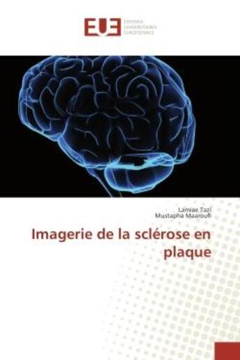 Couverture du livre « Imagerie de la sclerose en plaque » de Lamiae Tazi aux éditions Editions Universitaires Europeennes