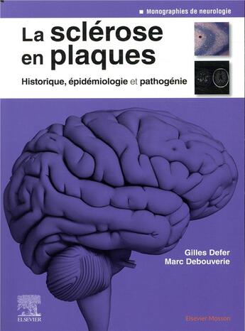 Couverture du livre « La sclérose en plaques ; historique, epidemiologie et pathogénie » de Gilles Defer et Marc Debouverie aux éditions Elsevier-masson