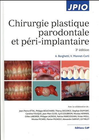 Couverture du livre « Chirurgie plastique parodontale et péri-implantaire (3e édition) » de Alain Borghetti et Virginie Monnet-Corti aux éditions Cahiers De Protheses