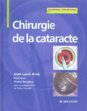 Couverture du livre « Chirurgie de la cataracte » de Arne Jean-Louis aux éditions Elsevier-masson